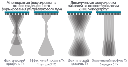 Динамическая фокусировка пикселей