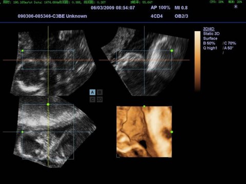 Ультразвуковой аппарат Mindray DC-7 - 2 286 800 руб.