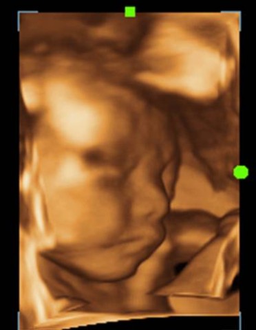 Ультразвуковой аппарат Mindray DC-7 - 2 286 800 руб.