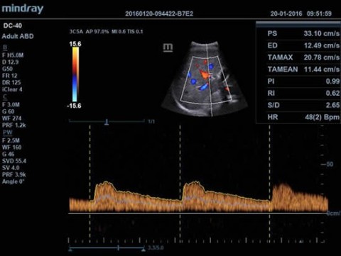Аппарат ультразвуковой диагностический DC-40 - 412 900 руб.