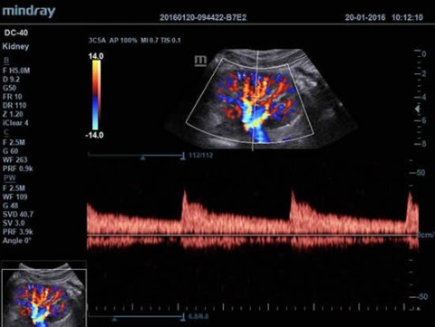 Аппарат ультразвуковой диагностический DC-40 - 412 900 руб.