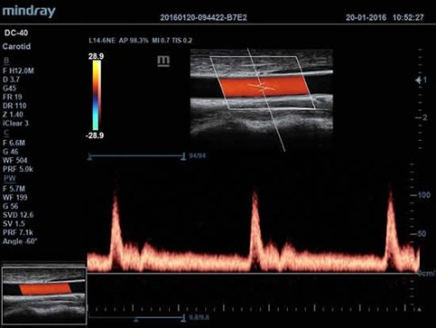 Аппарат ультразвуковой диагностический DC-40 - 412 900 руб.