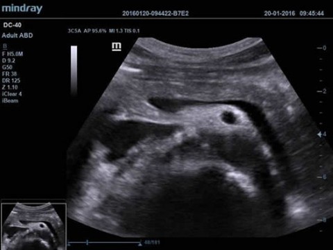 Аппарат ультразвуковой диагностический DC-40 - 412 900 руб.