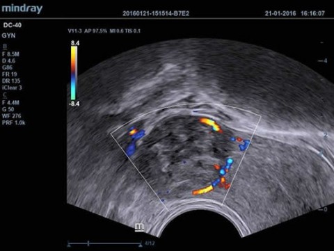 Аппарат ультразвуковой диагностический DC-40 - 412 900 руб.
