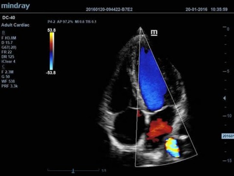 Аппарат ультразвуковой диагностический DC-40 - 412 900 руб.