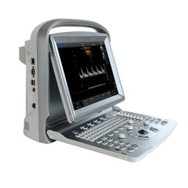 УЗИ аппарат Chison SonoTouch 20 (ECO 5)