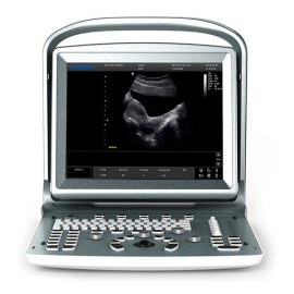 УЗИ аппарат Chison SonoTouch 20 (ECO 5)