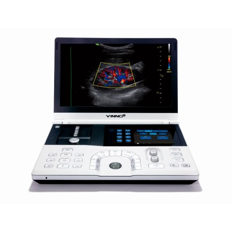 Портативный УЗИ аппарат VINNO 8 - 745 700 руб.