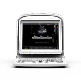 УЗИ аппарат Chison SonoTouch 30 (ECO 3 Expert)