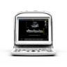 УЗИ аппарат Chison SonoTouch 30 (ECO 3 Expert)
