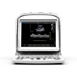 УЗИ аппарат Chison SonoTouch 30 (ECO 3 Expert)