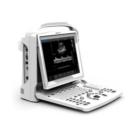 УЗИ аппарат Chison SonoTouch 30 (ECO 3 Expert)
