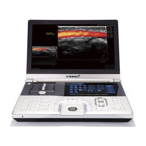 Портативный УЗИ сканер VINNO 5 - 717 700 руб.