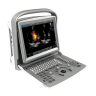 УЗИ аппарат Chison SonoTouch 50 (ECO 6)