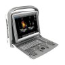 УЗИ аппарат Chison SonoTouch 50 (ECO 6)