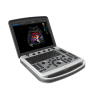 УЗИ аппарат Chison SonoTouch 80 (SonoBook 6)