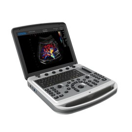 УЗИ аппарат Chison SonoTouch 80 (SonoBook 6)