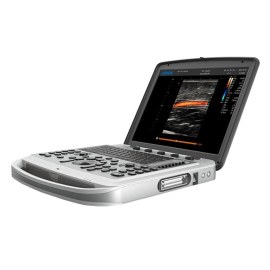 УЗИ аппарат Chison SonoTouch 80 (SonoBook 6)