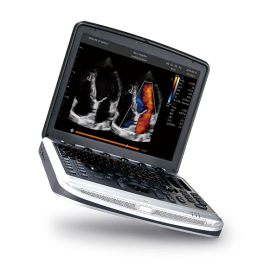 УЗИ аппарат Chison SonoTouch 80 (SonoBook 8)
