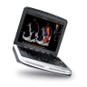 УЗИ аппарат Chison SonoTouch 80 (SonoBook 8)