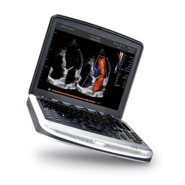 УЗИ аппарат Chison SonoTouch 80 (SonoBook 8)