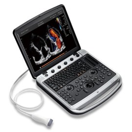 УЗИ аппарат Chison SonoTouch 80 (SonoBook 9)
