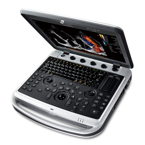 УЗИ аппарат Chison SonoBook 7 - 1 300 000 руб.