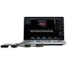 УЗИ аппарат Chison SonoAir 60 - 600 000 руб.