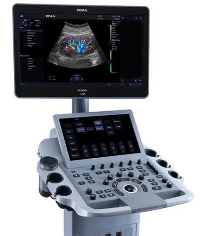 УЗИ аппарат Edan Acclarix LX25 - 940 247 руб.
