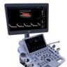 УЗИ аппарат Edan Acclarix LX9 - 2 394 319 руб.