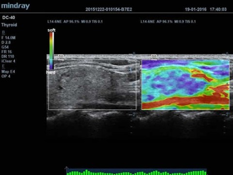 Аппарат ультразвуковой диагностический DC-40 - 385 200 руб.
