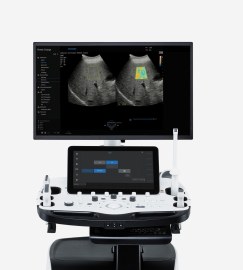 УЗИ сканер Samsung Medison RS85