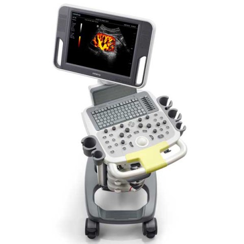 УЗИ сканер Mindray DC-N3 - 299 300 руб.
