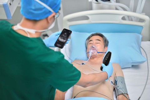 УЗИ сканер Mindray TE Air i3P - 329 800 руб.