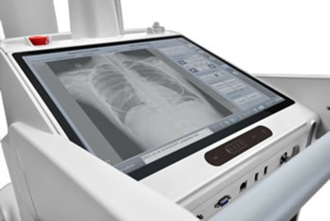 Мобильный цифровой рентгеновский аппарат Mindray MobiEye 700 - 0 руб.
