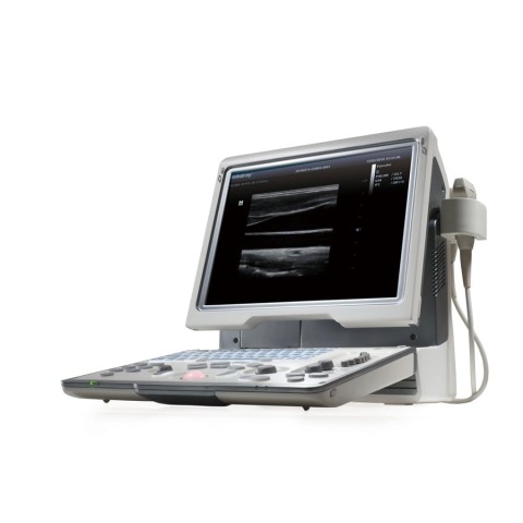 УЗИ аппарат Mindray DP-50 Color - 355 600 руб.