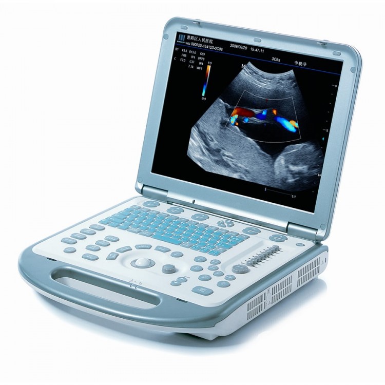 Mindray M5 NEW узи сканер портативный - 643 990 руб.