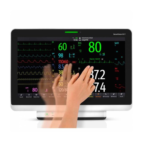 Монитор пациента Mindray BeneVision N17 - 0 руб.